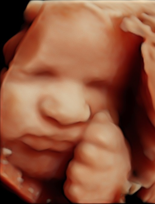 Ecografía de Crecimiento 7D Doppler Gemelar