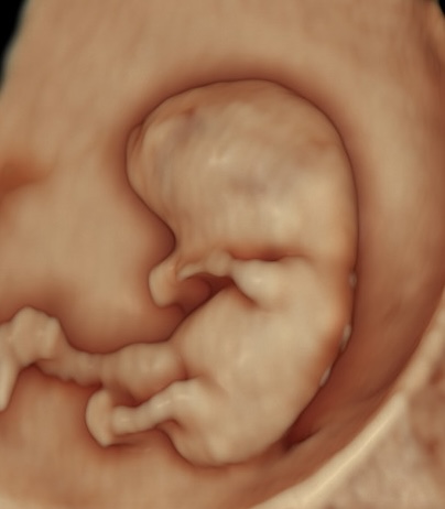 Ecografía de Viabilidad